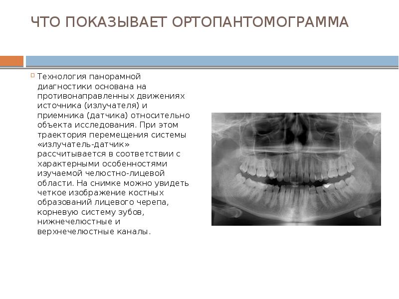 Схема описания ортопантомограммы