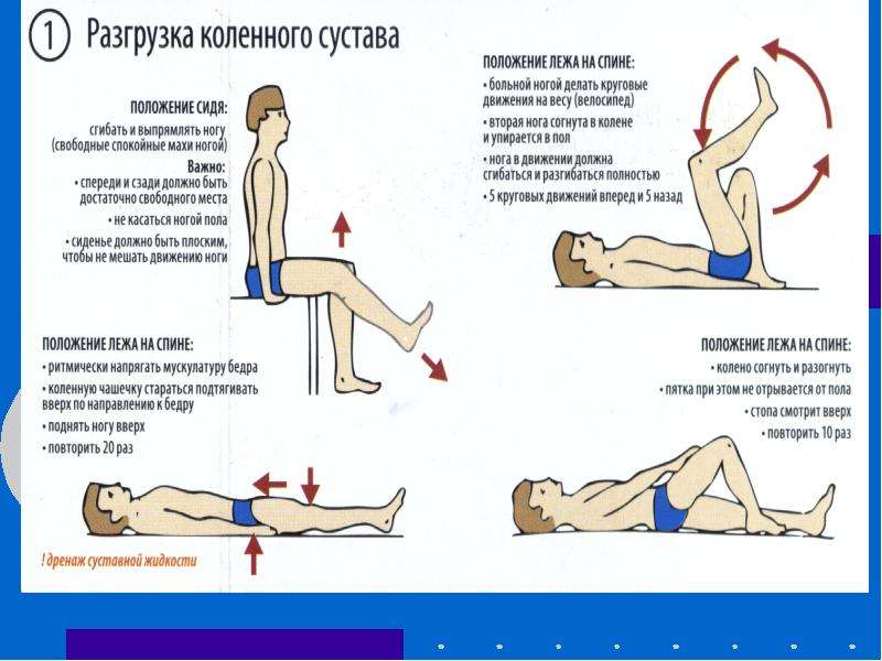 Лечение остеоартроза презентация