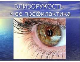 Близорукость и ее профилактика
