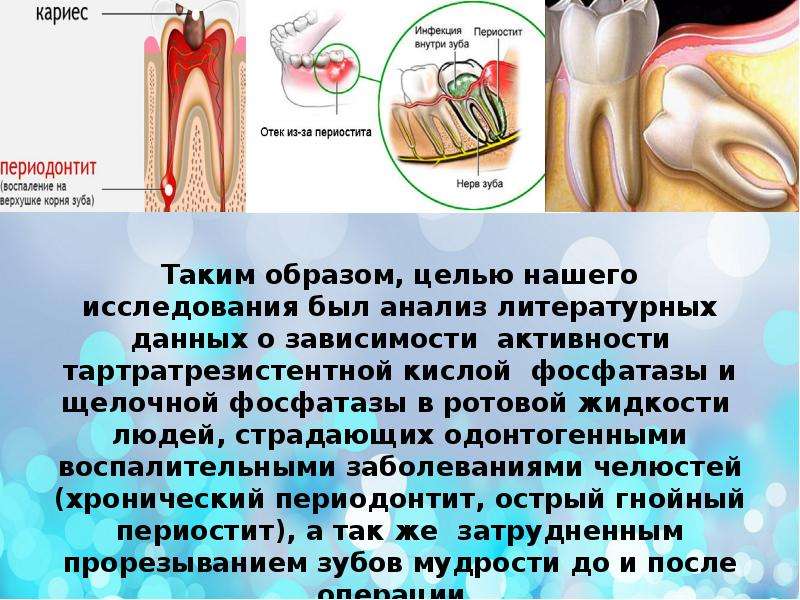 Лечение периостита Томск Пожарского стоматология улыбка лазо томск