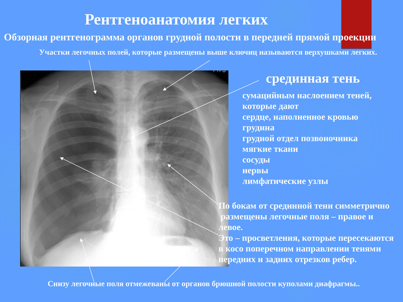 Лучевая диагностика органов дыхания презентация