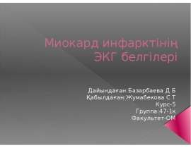 Миокард инфаркті ЭКГ белгілері