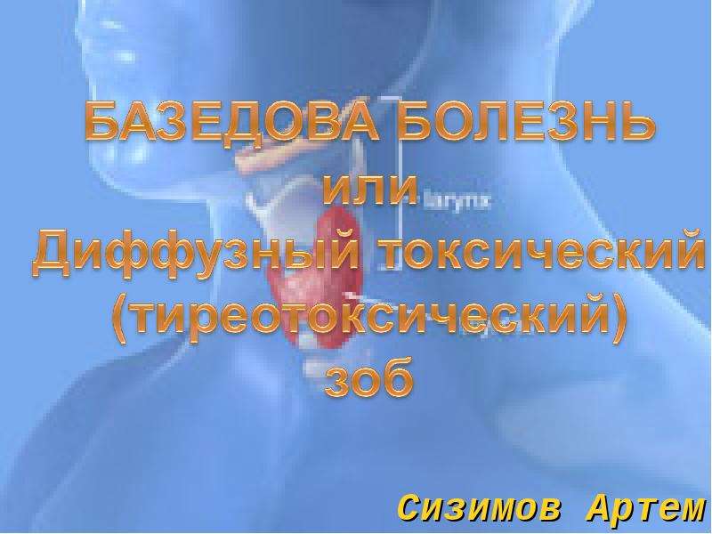 Диффузный токсический зоб презентация