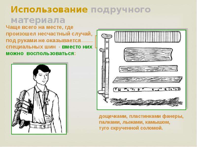 Задачи иммобилизации