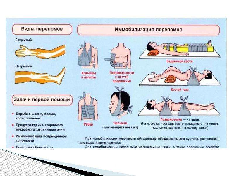 Доврачебная помощь при клинической смерти презентация