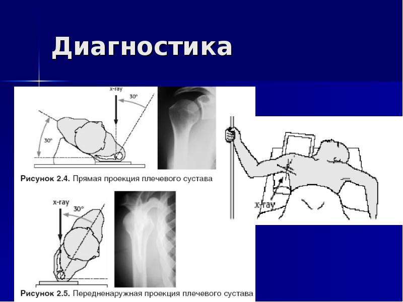 Диагностика 23. Камертоновая проба(Верхние конечности.