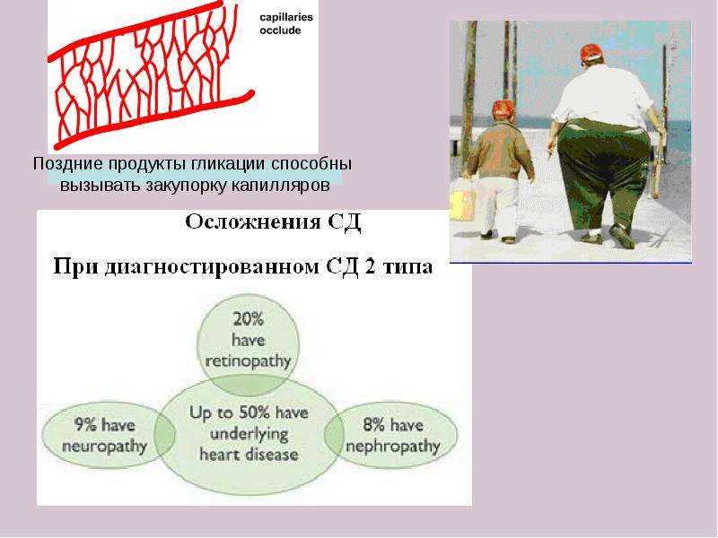Биохимические механизмы нарушения обмена углеводов и липидов, слайд 23
