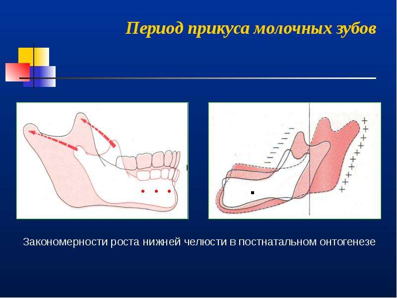 Периоды роста челюстей. Рост нижней челюсти. Зоны роста нижней челюсти. Рост нижней челюсти в постнатальном периоде. Этиопатогенез зубочелюстных аномалий.