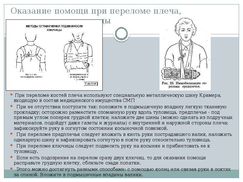 Карта вызова перелом руки