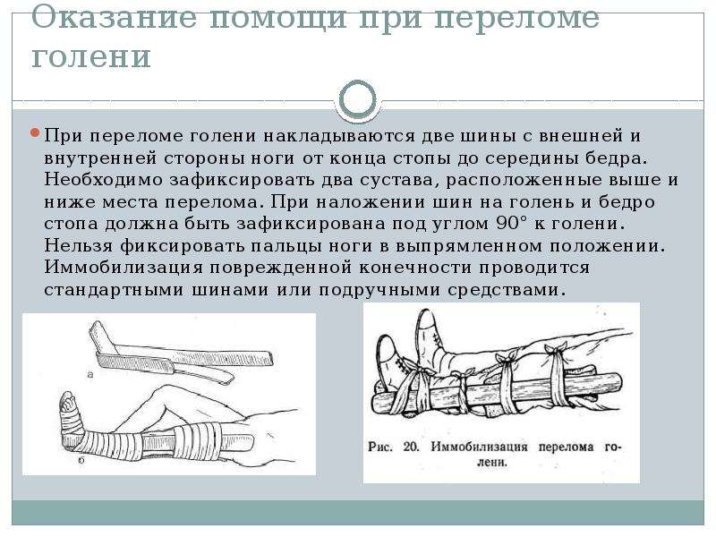 Открытый перелом голени карта вызова смп