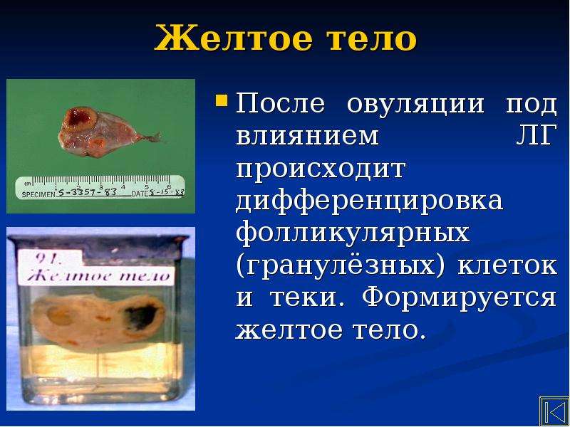 После овуляции желтое. Желтое тело после овуляции. Функции желтого тела. После овуляции жолти тела. Желтое тело формируется.