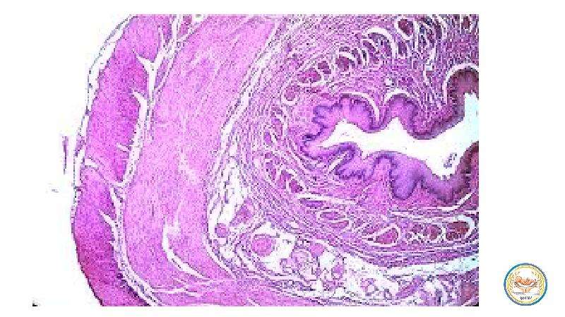 Пищевод гистология. Пищевод гистология препарат. Стенка пищевода гистология. Пищевод микропрепарат гистология. Кардиальные железы пищевода гистология.