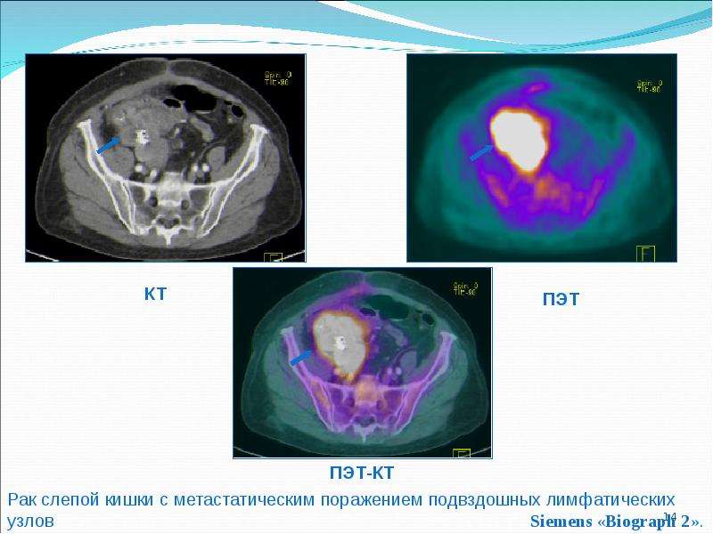 Презентация пэт кт