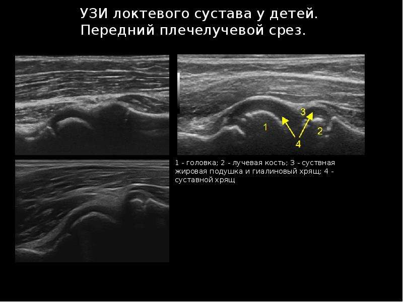 Узи суставов презентация