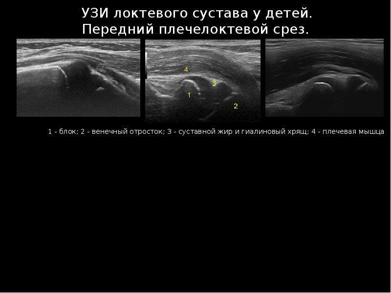 Узи суставов презентация