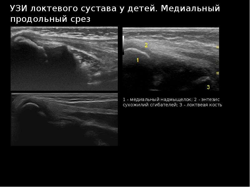 Узи суставов презентация