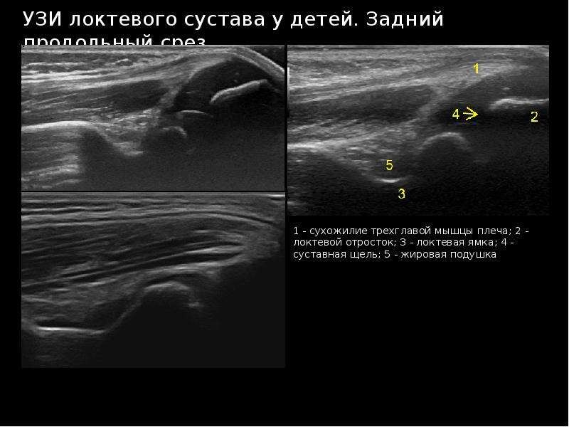 Узи суставов презентация